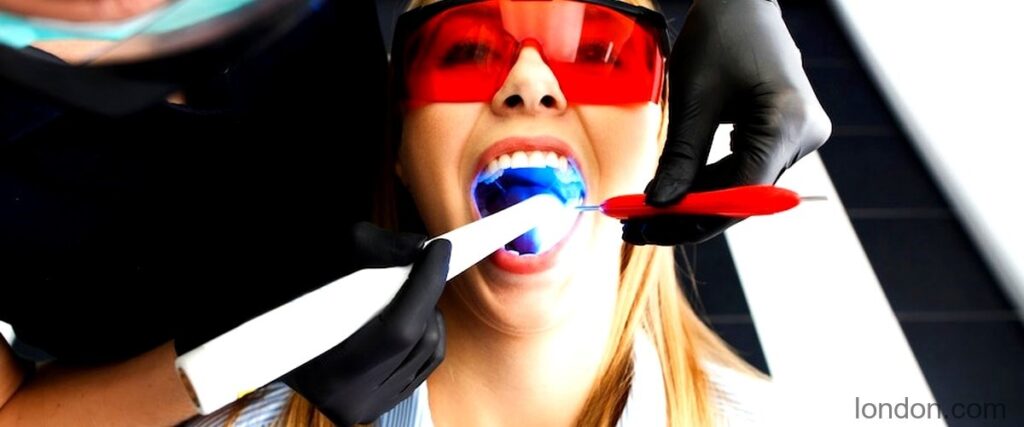 Top 7 Best Teeth Whitening Services in London